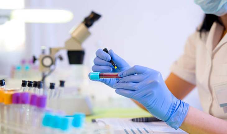 blood test