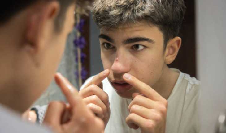 pimple near the nose