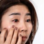 Eyes में जलन और सूखापन? वजह जानकर हैरान रह जाएंगे!