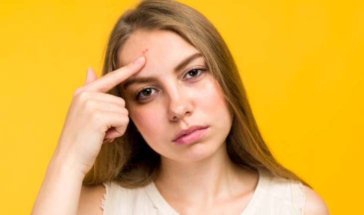 pimples keep appearing on your face