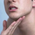 क्या Chin के ये दाने आपके स्वास्थ्य के लिए खतरा हैं?