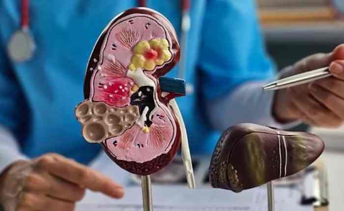 kidney damage