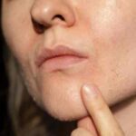 WinterSkinCare: ड्राई स्किन से छुटकारा पाएं तुरंत