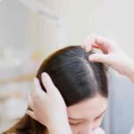 ScalpPimples: का असली कारण क्या है? डॉक्टर क्या बताते हैं