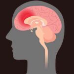 BrainHemorrhageSymptoms: ब्रेन हैमरेज से पहले शरीर देता है ये चेतावनी संकेत