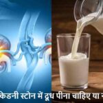 KidneyStone: किडनी स्टोन में दूध पीना सही या गलत? जानिए डॉक्टर की राय