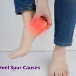 HeelSpurCauses: एड़ी में हड्डी क्यों बढ़ती है? जानें कारण