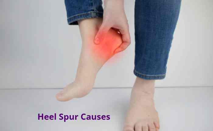 Heel Spur Causes