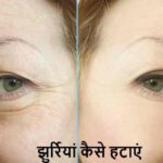 Wrinkles Removal: झुर्रियां हटाने का देसी तरीका, एक बार जरूर ट्राई करें