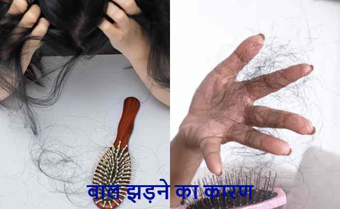 hair fall vitamin deficiency