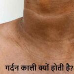 Skin Care Tips: क्या आपकी गर्दन काली हो रही है? जानिए इसका कारण
