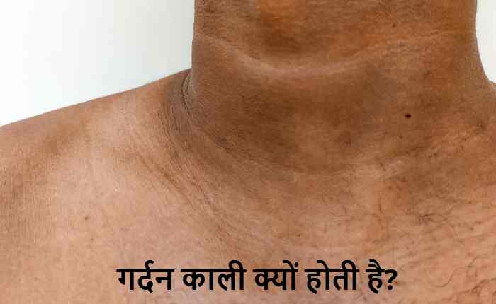 neck darkening causes