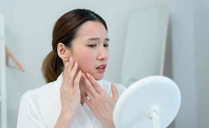 कैसे करें बचाव?