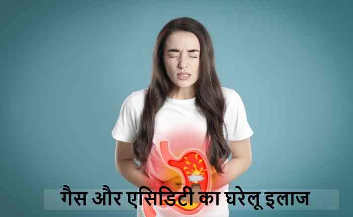 acidity relief home remedy