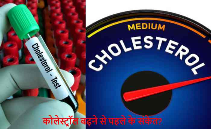 कोलेस्ट्रॉल बढ़ने के शुरुआती संकेत