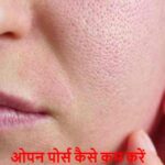 SkinCareTips: ओपन पोर्स से छुटकारा पाने का सबसे आसान तरीका!