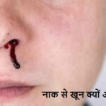 SummerHealth: गर्मी में अचानक नाक से खून? ये संकेत हो सकते हैं खतरनाक