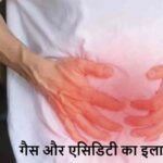 Health Tips: गैस और एसिडिटी से छुटकारा चाहिए? सुबह ये जरूर खाएं!