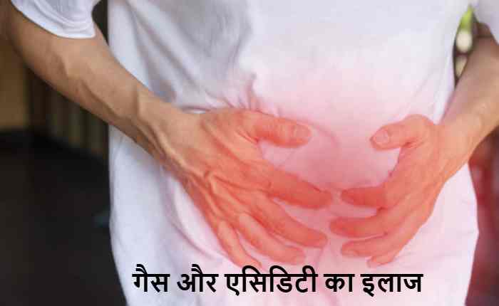 acidity relief home remedies