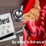 Cholesterol: बैड कोलेस्ट्रॉल हाई है? तुरंत खाना बंद करें ये 5 चीजें!