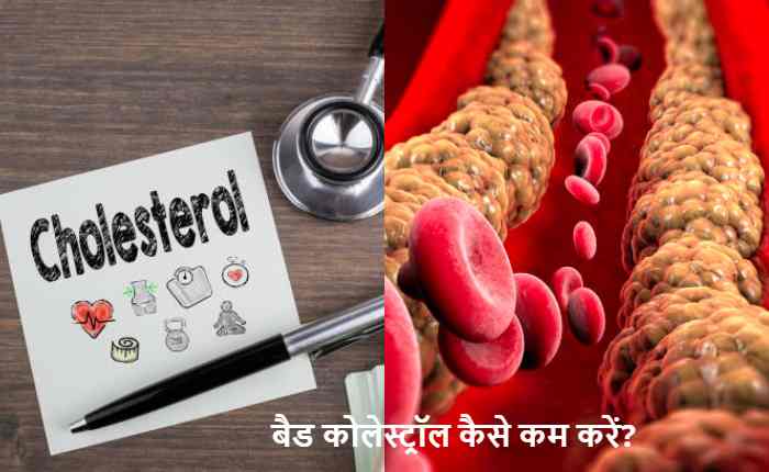 Cholesterol Control Tips