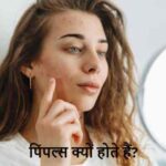 SkinCare: बार-बार पिंपल्स हो रहे हैं? कहीं ये विटामिन की कमी तो नहीं!