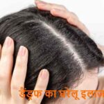 HairCare: सिर से झड़ता डैंड्रफ खत्म करने का आसान घरेलू उपाय