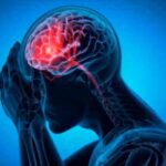 Brain Stroke Causes: ब्रेन स्ट्रोक का सबसे बड़ा कारण क्या है?