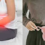 PCOS के ये शुरुआती लक्षण भूलकर भी नजरअंदाज न करें!