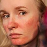 Skin Redness: स्किन रेडनेस का सबसे बड़ा ट्रिगर क्या है?