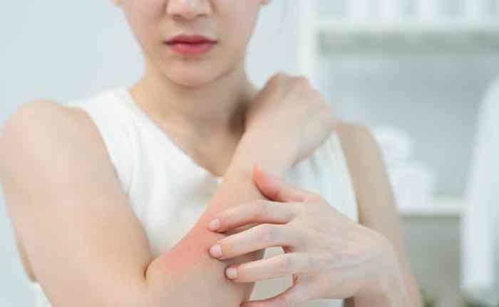 Skin Redness: