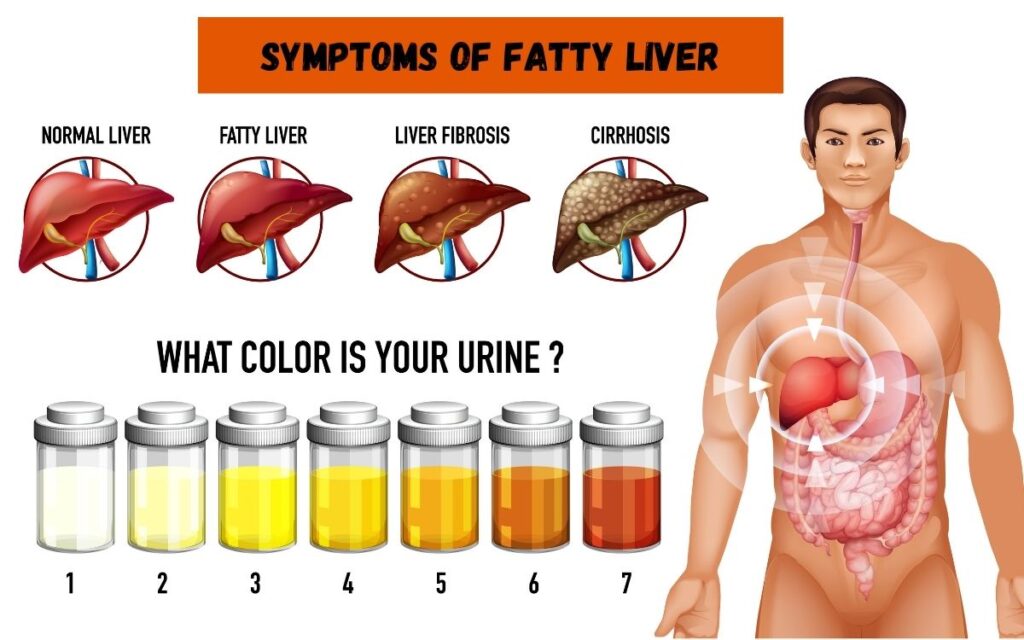 Fatty Liver के लक्षण
